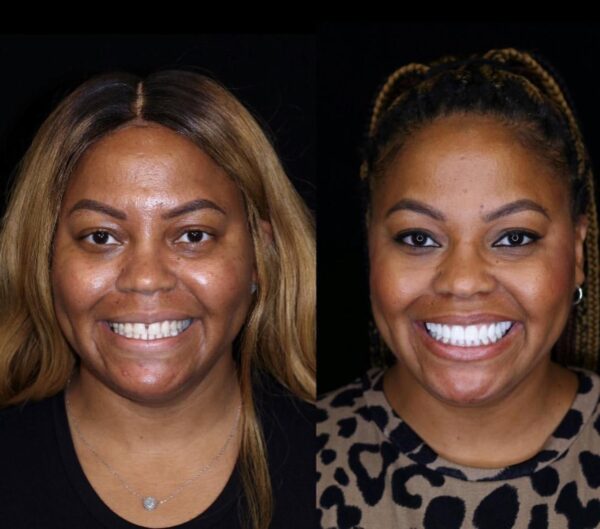 Dental Treatment in Istanbul Guide