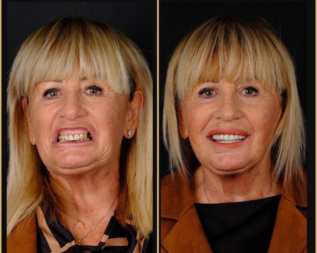 Dentist in Taksim