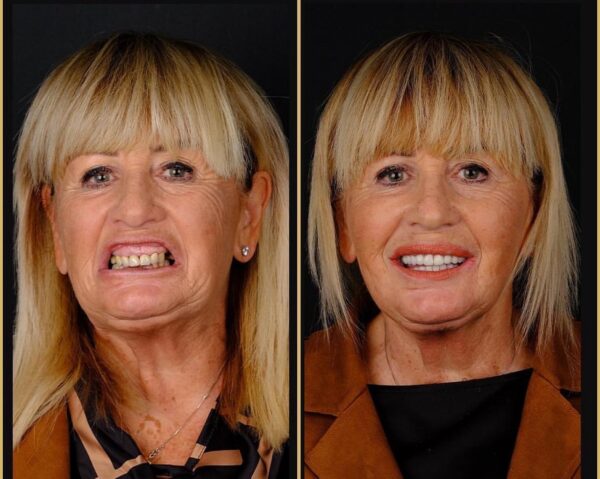 Dentist in Taksim