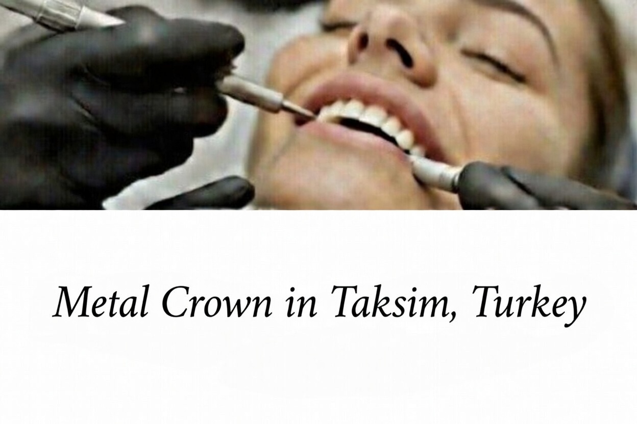 Metal Crown in Taksim, Turkey